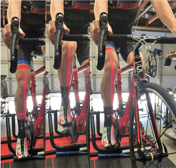 Knee Alignment